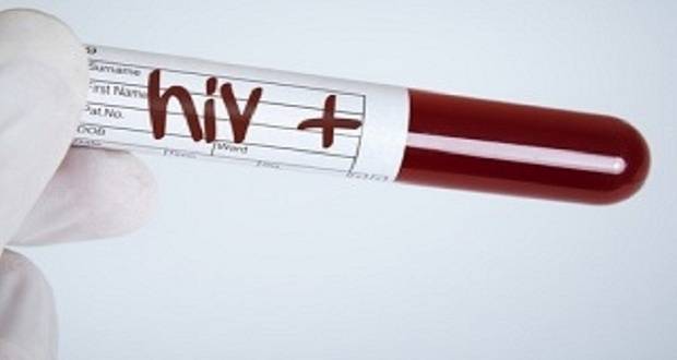 Number of HIV AIDS Cases in Larkana Jumps to 93