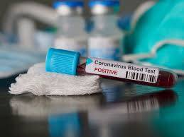 Coronavirus: Patient in their 30s dies after attending 'Covid party'