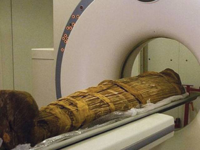 CT scan of mummies reveal they had heart diseases