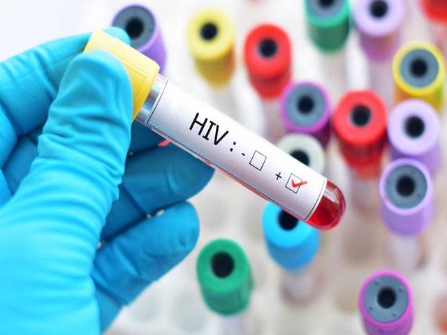 607 people tested HIV-positive in Larkana: NACP