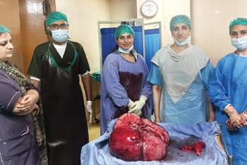 Lahore doctors remove 25-kg tumor from uterus