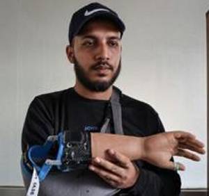 Wounded Bangladesh protesters receive robotic helping hand